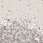 Atlas Antibodies Anti-SON Antibody