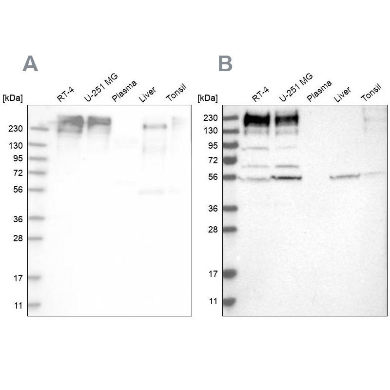 Atlas Antibodies Anti-SON Antibody