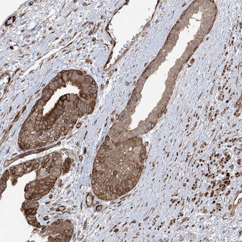 Atlas Antibodies Anti-SOGA3 Antibody