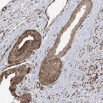 Atlas Antibodies Anti-SOGA3 Antibody