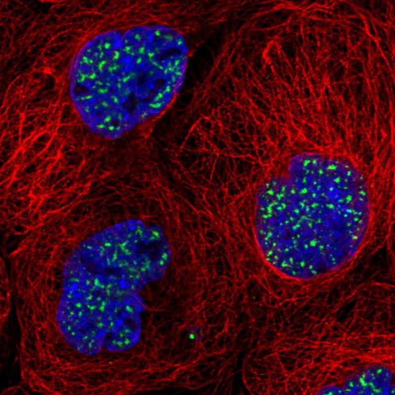 Atlas Antibodies Anti-SON Antibody