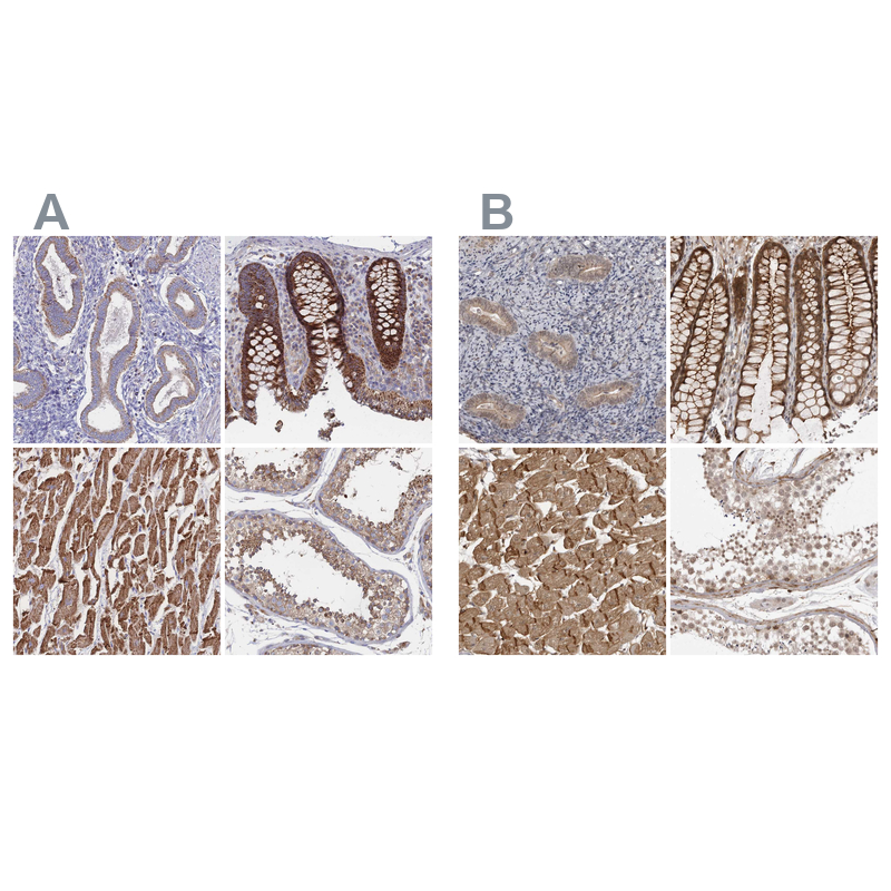 Atlas Antibodies Anti-SORBS1 Antibody