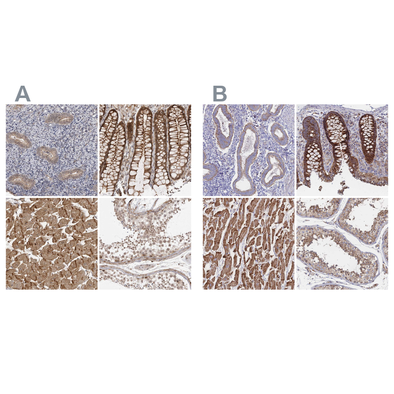 Atlas Antibodies Anti-SORBS1 Antibody