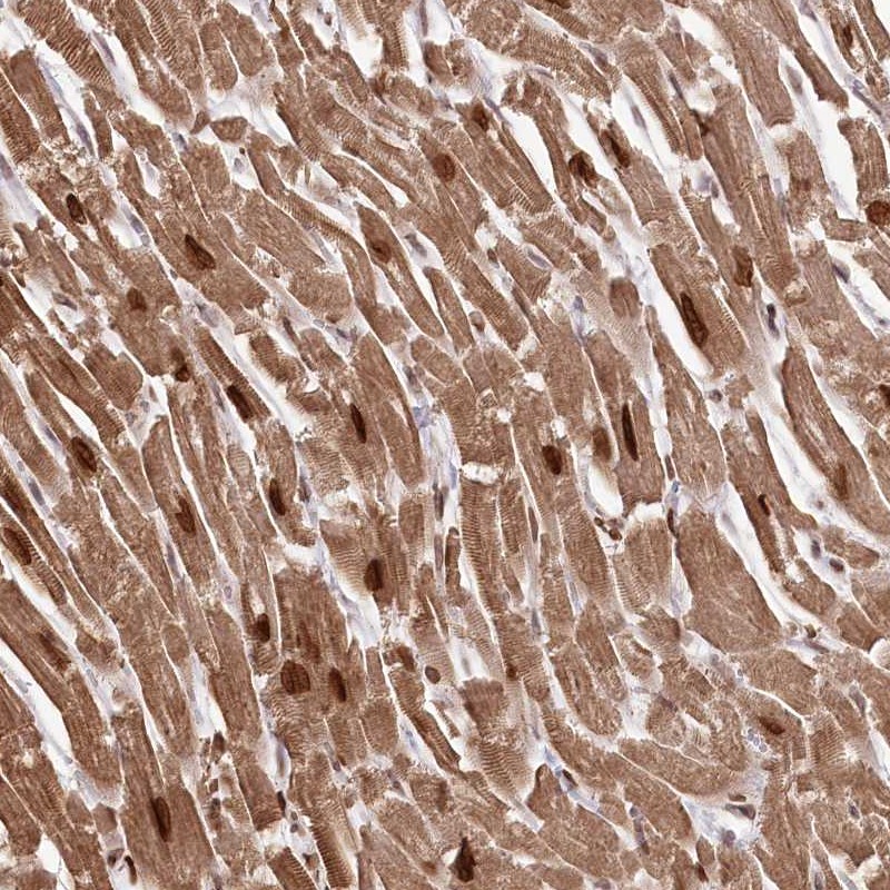 Atlas Antibodies Anti-SORBS2 Antibody