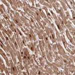 Atlas Antibodies Anti-SORBS2 Antibody