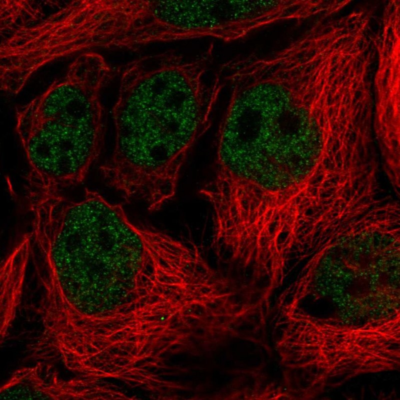 Atlas Antibodies Anti-SORBS3 Antibody