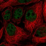 Atlas Antibodies Anti-SORBS3 Antibody