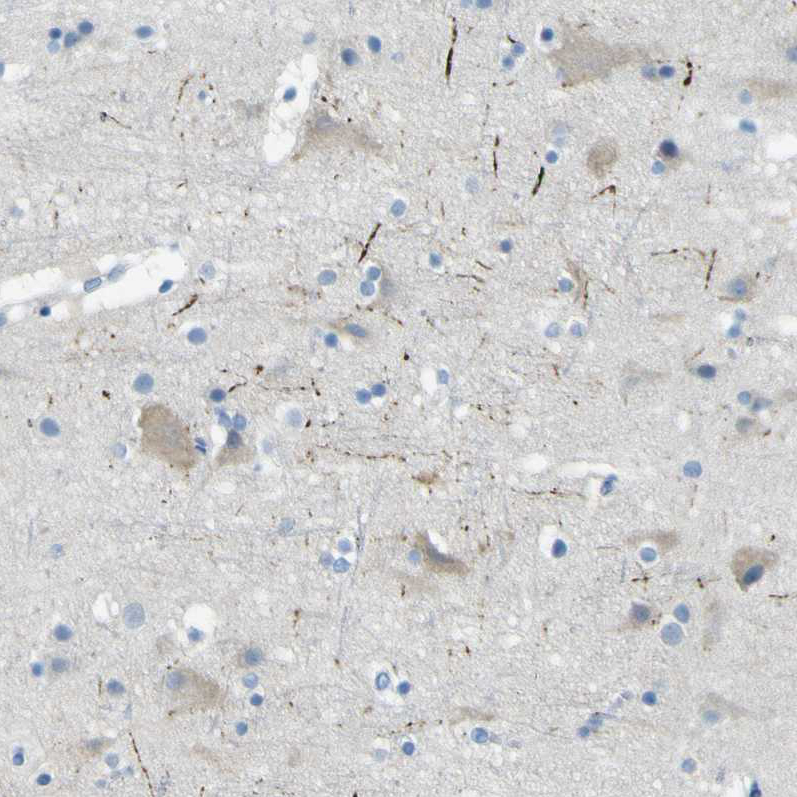 Atlas Antibodies Anti-SORCS1 Antibody
