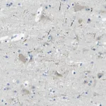 Atlas Antibodies Anti-SORCS1 Antibody