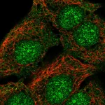 Atlas Antibodies Anti-SORCS2 Antibody