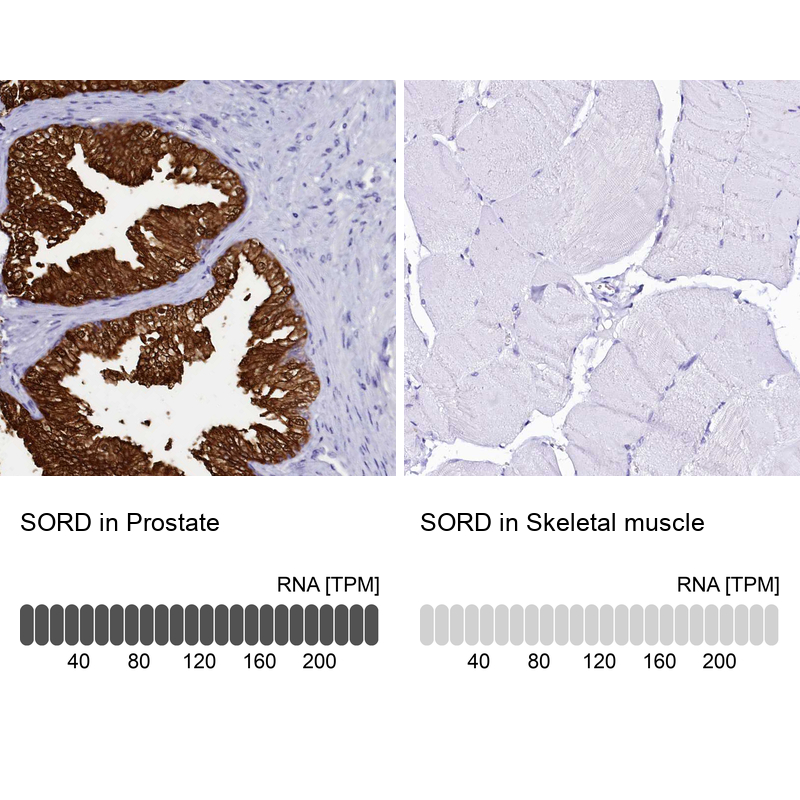 Atlas Antibodies Anti-SORD Antibody