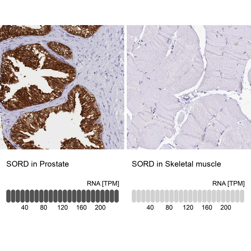 Atlas Antibodies Anti-SORD Antibody