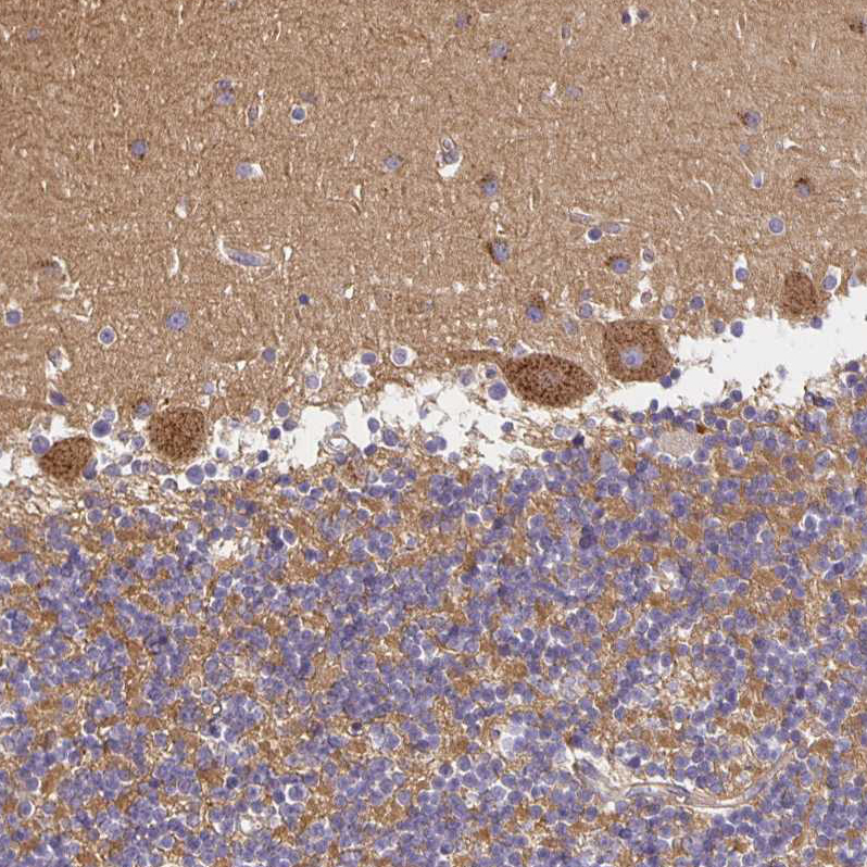 Atlas Antibodies Anti-SORL1 Antibody