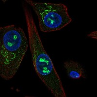 Atlas Antibodies Anti-SOSTDC1 Antibody