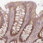 Atlas Antibodies Anti-SOS2 Antibody