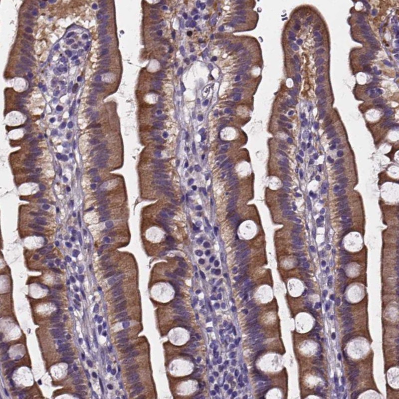 Atlas Antibodies Anti-SOWAHA Antibody