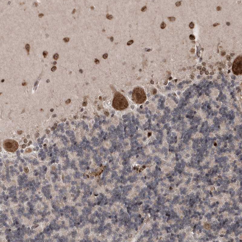 Atlas Antibodies Anti-SOWAHB Antibody