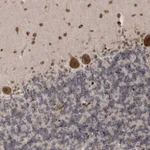 Atlas Antibodies Anti-SOWAHB Antibody