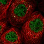 Atlas Antibodies Anti-SOS2 Antibody