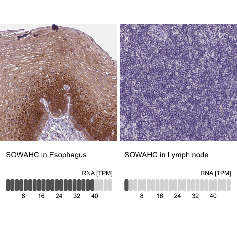 Atlas Antibodies Anti-SOWAHC Antibody
