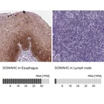 Atlas Antibodies Anti-SOWAHC Antibody