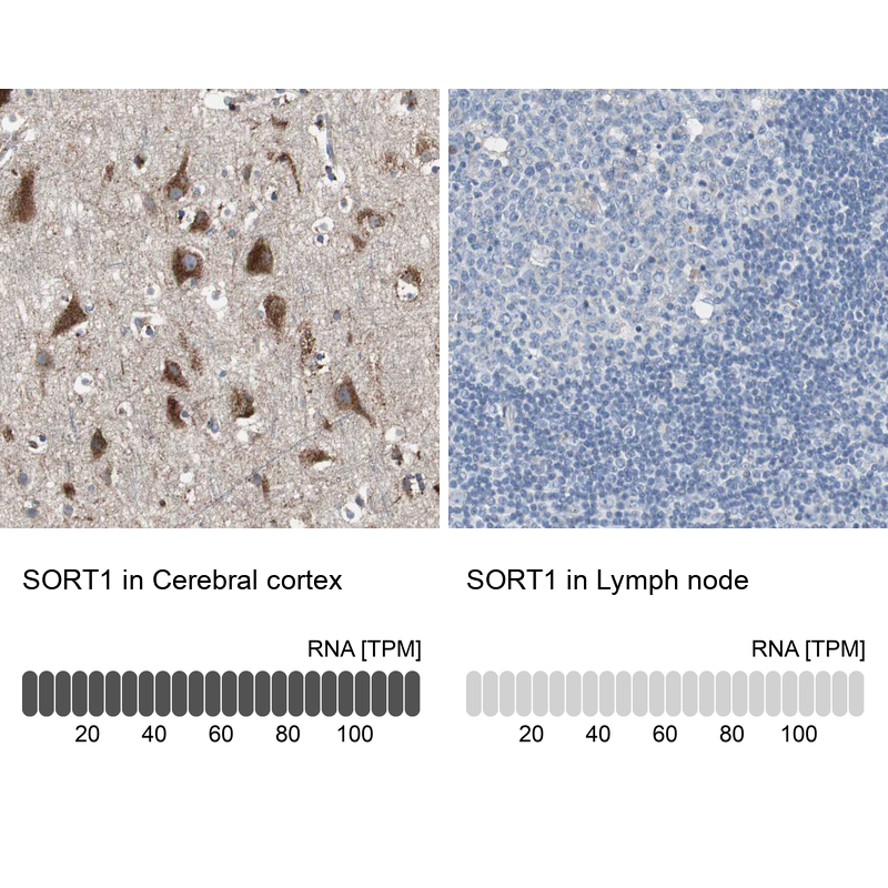 Atlas Antibodies Anti-SORT1 Antibody
