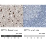 Atlas Antibodies Anti-SORT1 Antibody