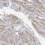 Atlas Antibodies Anti-SOWAHD Antibody