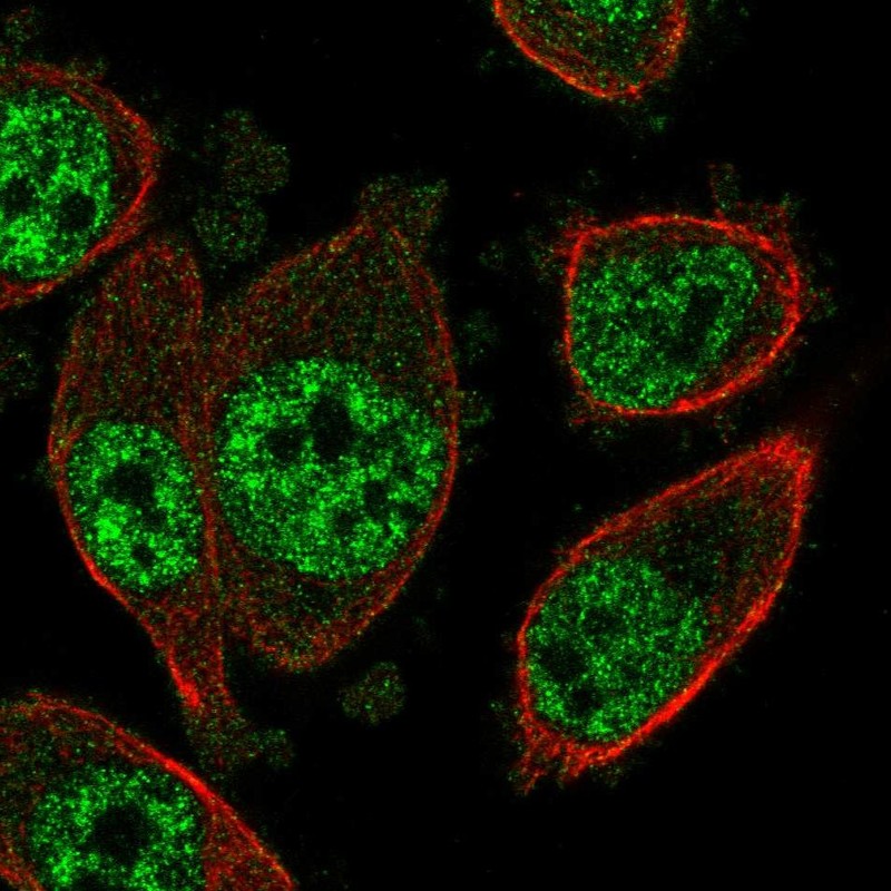 Atlas Antibodies Anti-SOX12 Antibody