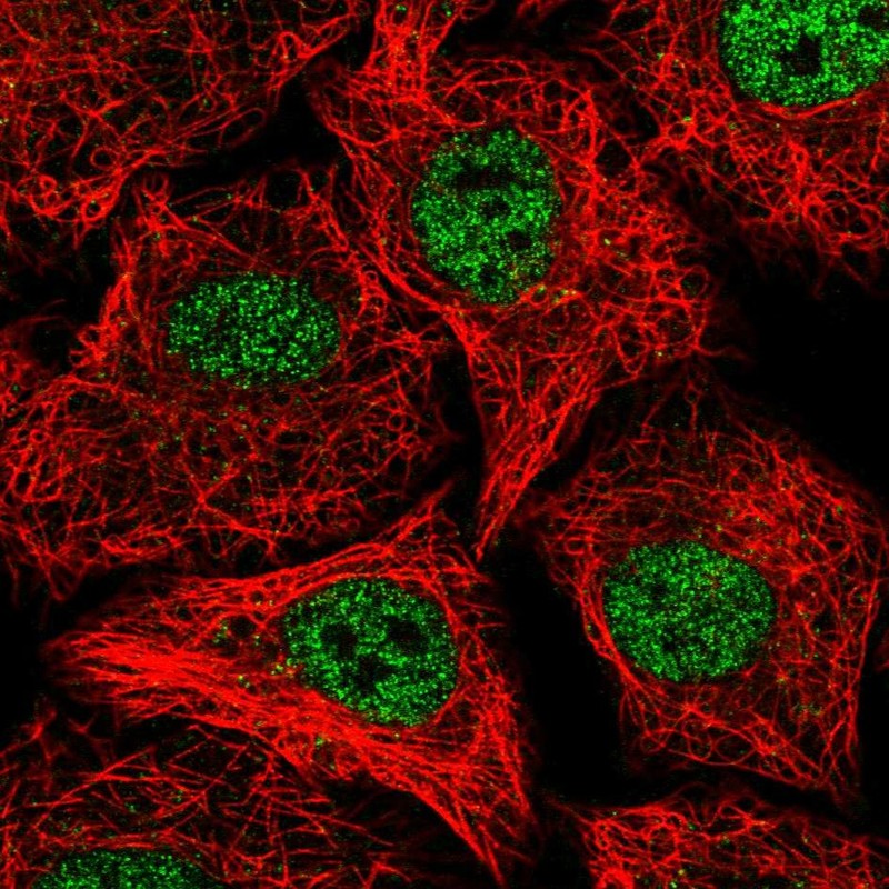 Atlas Antibodies Anti-SOX12 Antibody