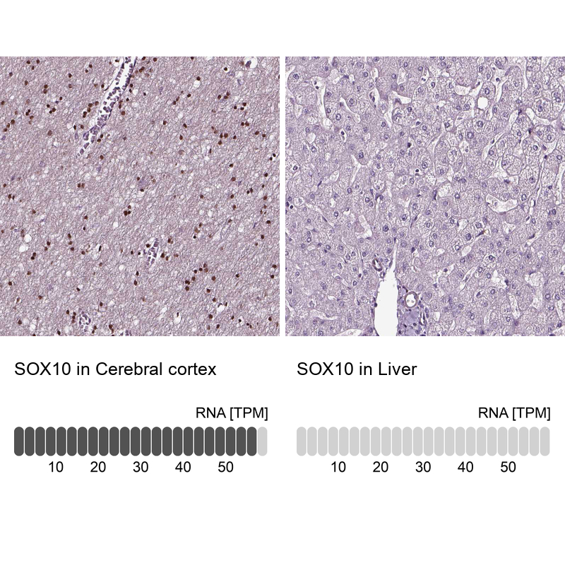 Atlas Antibodies Anti-SOX10 Antibody