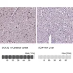 Atlas Antibodies Anti-SOX10 Antibody