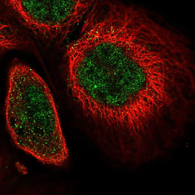 Atlas Antibodies Anti-SOX13 Antibody
