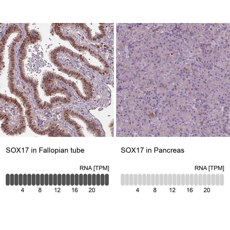Atlas Antibodies Anti-SOX17 Antibody