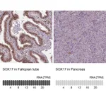 Atlas Antibodies Anti-SOX17 Antibody