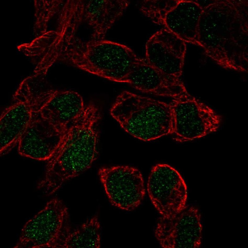 Atlas Antibodies Anti-SOX18 Antibody