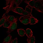 Atlas Antibodies Anti-SOX18 Antibody