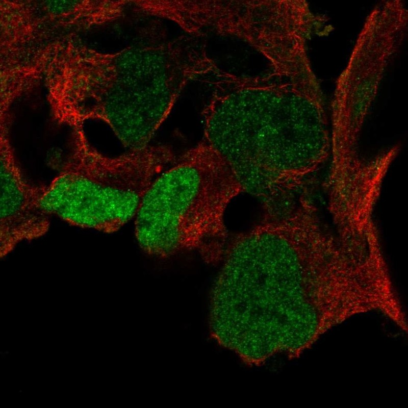 Atlas Antibodies Anti-SOX3 Antibody