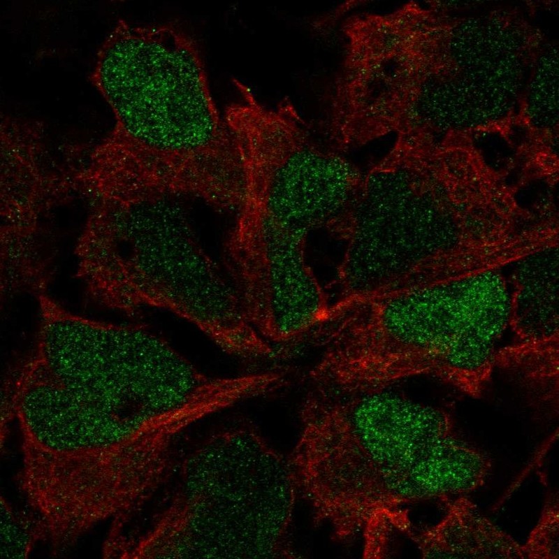 Atlas Antibodies Anti-SOX3 Antibody
