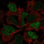 Atlas Antibodies Anti-SOX3 Antibody