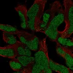 Atlas Antibodies Anti-SOX21 Antibody