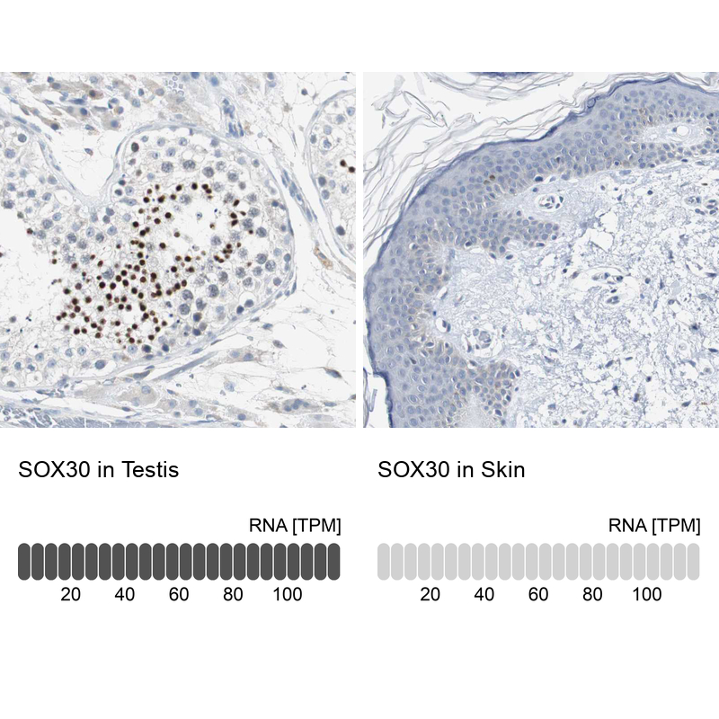 Atlas Antibodies Anti-SOX30 Antibody