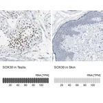 Atlas Antibodies Anti-SOX30 Antibody