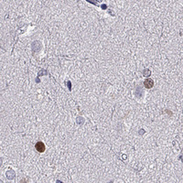 Atlas Antibodies Anti-SOX21 Antibody