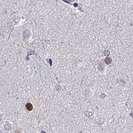 Atlas Antibodies Anti-SOX21 Antibody