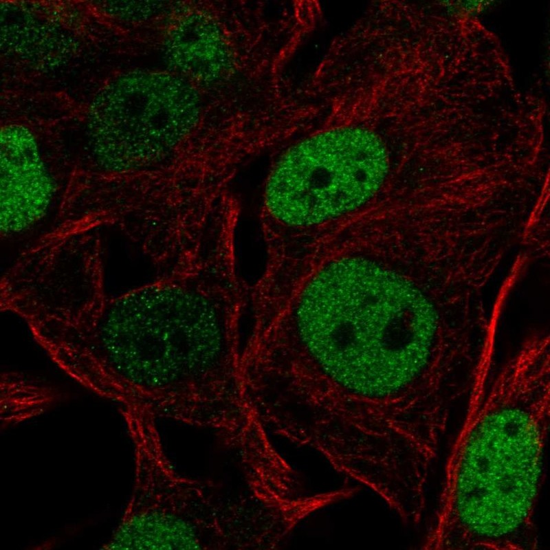 Atlas Antibodies Anti-SOX5 Antibody