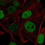 Atlas Antibodies Anti-SOX5 Antibody