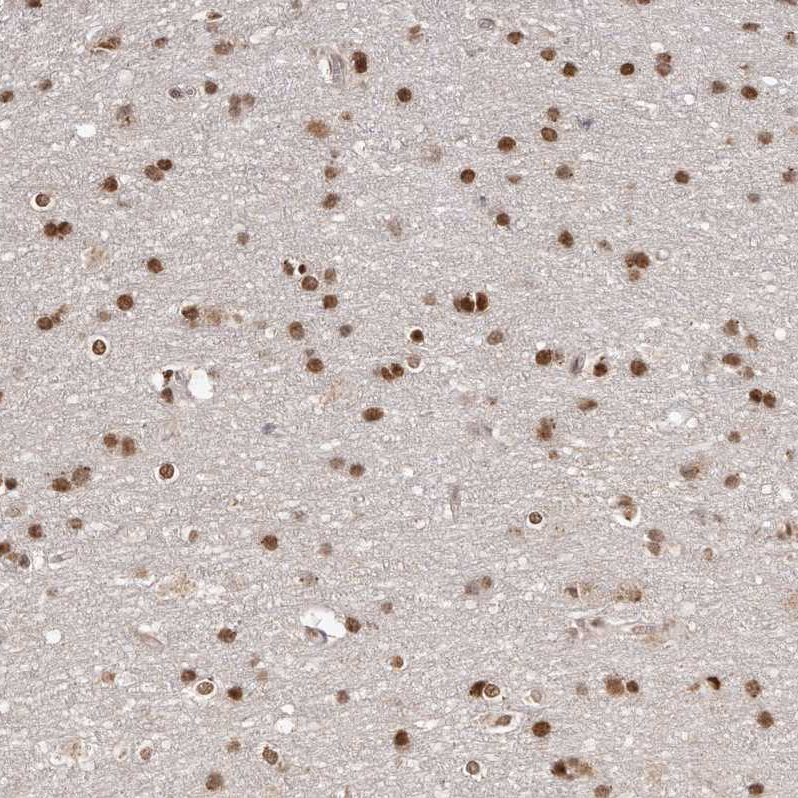 Atlas Antibodies Anti-SOX4 Antibody