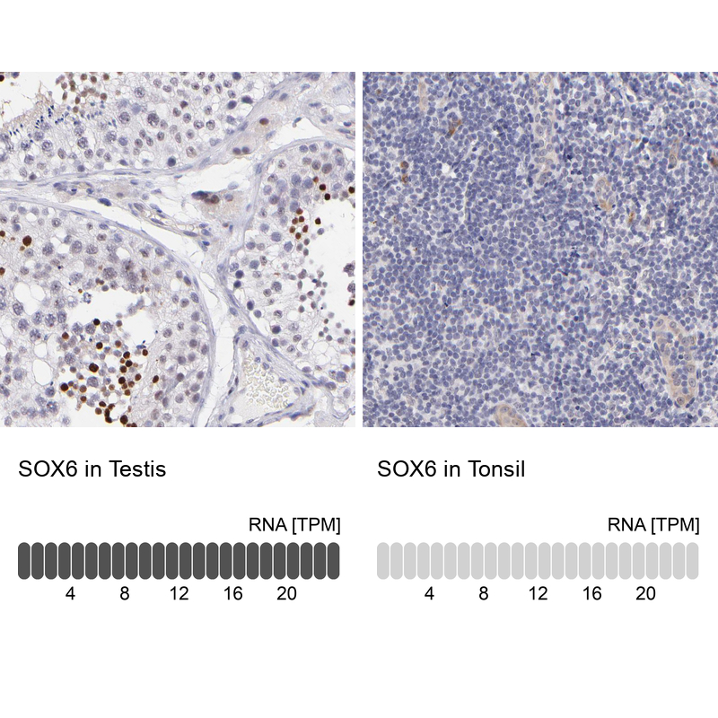 Atlas Antibodies Anti-SOX6 Antibody