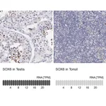 Atlas Antibodies Anti-SOX6 Antibody